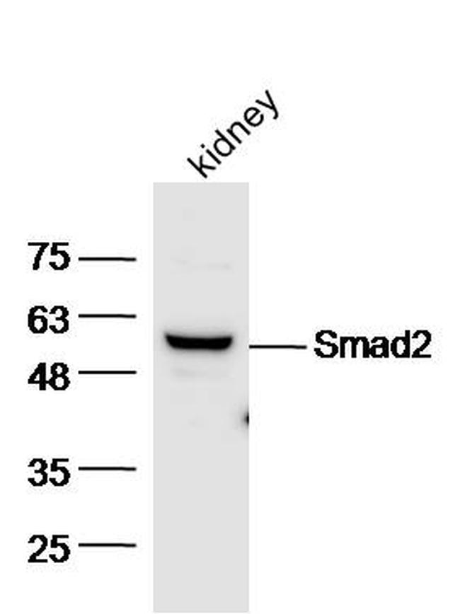 Smad2 Antibody in Western Blot (WB)