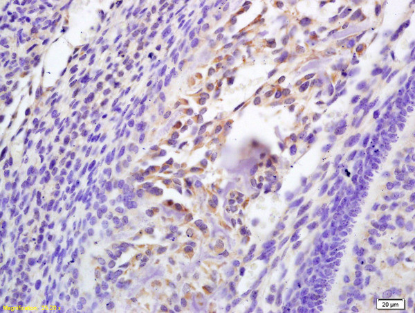 Galectin 3 Antibody in Immunohistochemistry (Paraffin) (IHC (P))