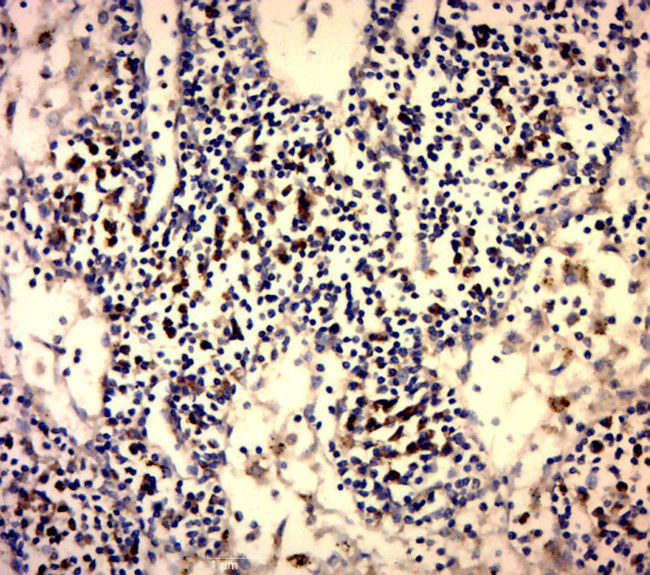 Galectin 3 Antibody in Immunohistochemistry (Paraffin) (IHC (P))