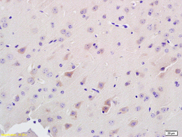 ADAMTS7 Antibody in Immunohistochemistry (Paraffin) (IHC (P))