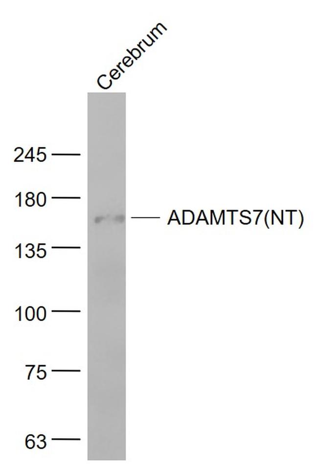 ADAMTS7 Antibody in Western Blot (WB)