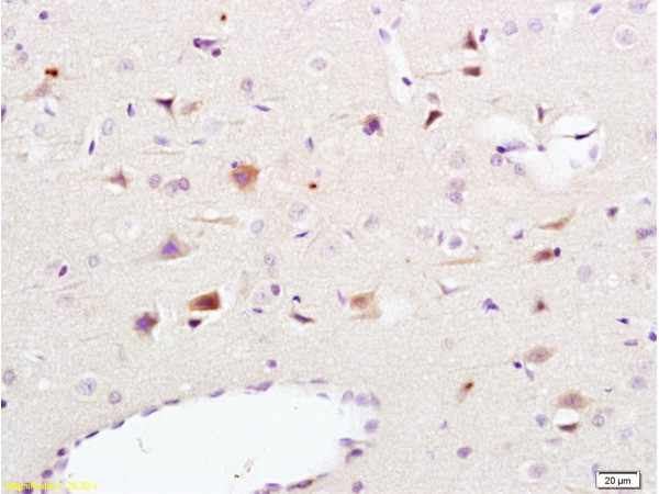 CD56 Antibody in Immunohistochemistry (Paraffin) (IHC (P))