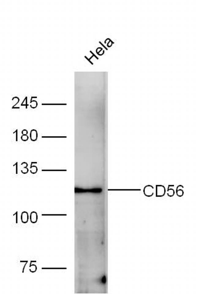 CD56 Antibody in Western Blot (WB)