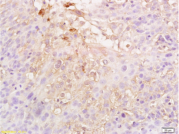 HIF-1 Alpha Antibody in Immunohistochemistry (Paraffin) (IHC (P))