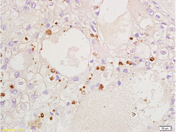 CDKN1B Antibody in Immunohistochemistry (Paraffin) (IHC (P))