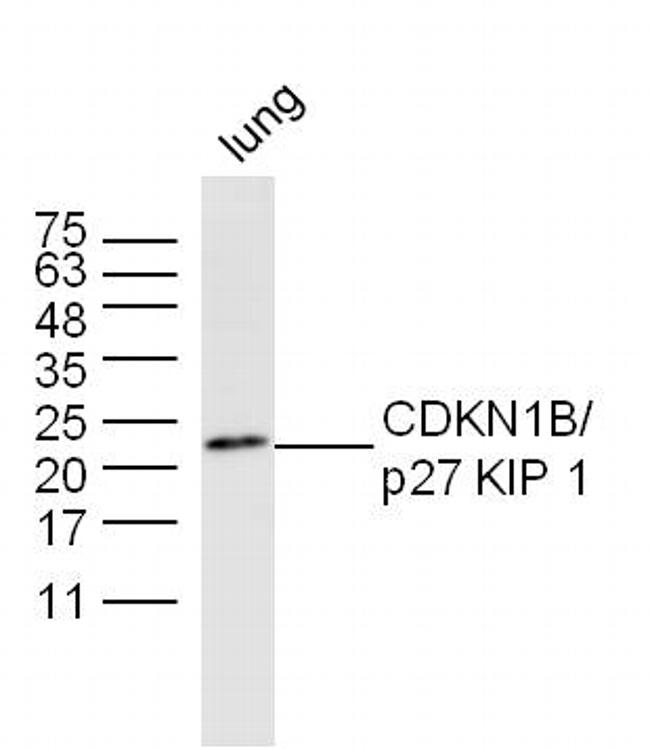 CDKN1B Antibody in Western Blot (WB)