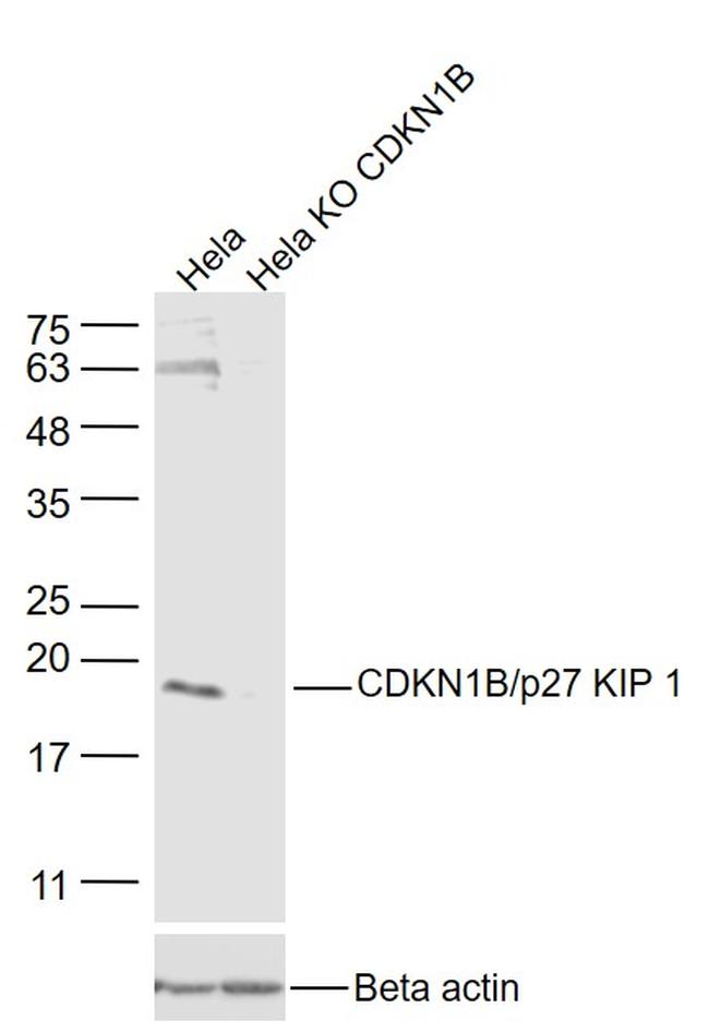 CDKN1B Antibody in Western Blot (WB)