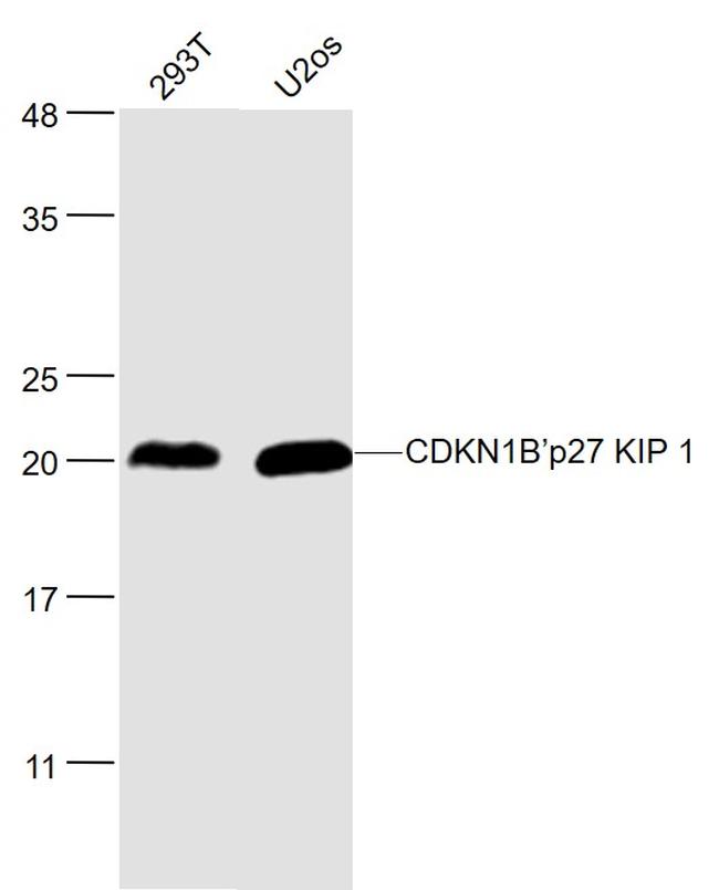 CDKN1B Antibody in Western Blot (WB)