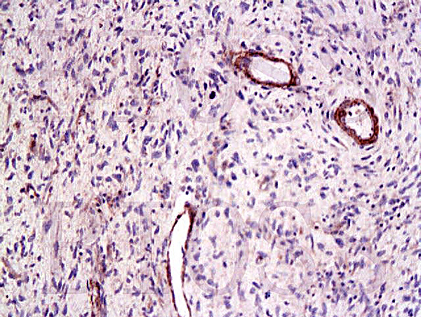 CTGF Antibody in Immunohistochemistry (Paraffin) (IHC (P))