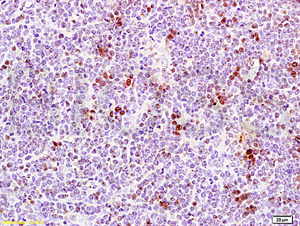 PCNA Antibody in Immunohistochemistry (Paraffin) (IHC (P))