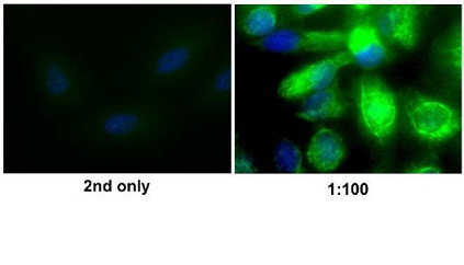 Vimentin Antibody in Immunocytochemistry (ICC/IF)