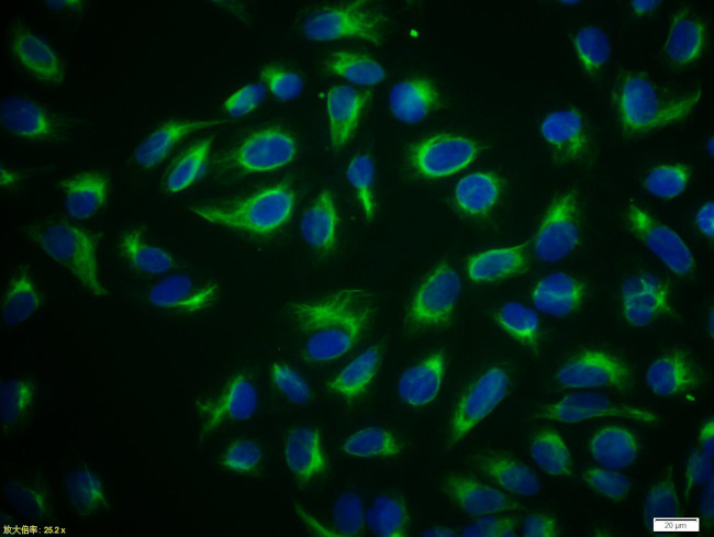 Vimentin Antibody in Immunocytochemistry (ICC/IF)