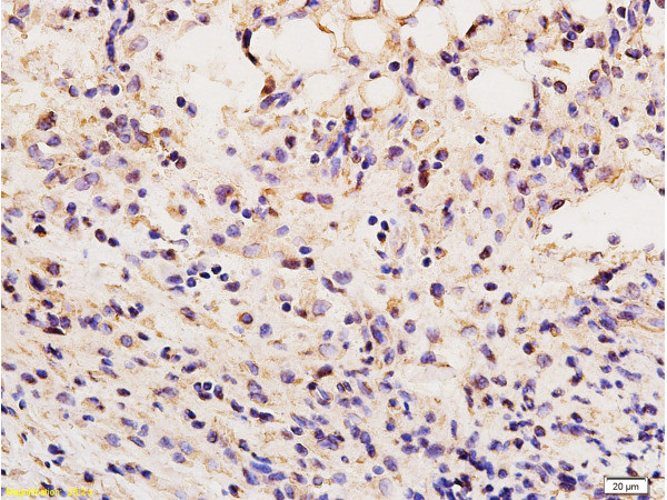 Vimentin Antibody in Immunohistochemistry (Paraffin) (IHC (P))