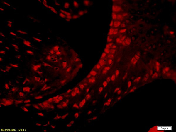 CD4 Antibody in Immunohistochemistry (Paraffin) (IHC (P))