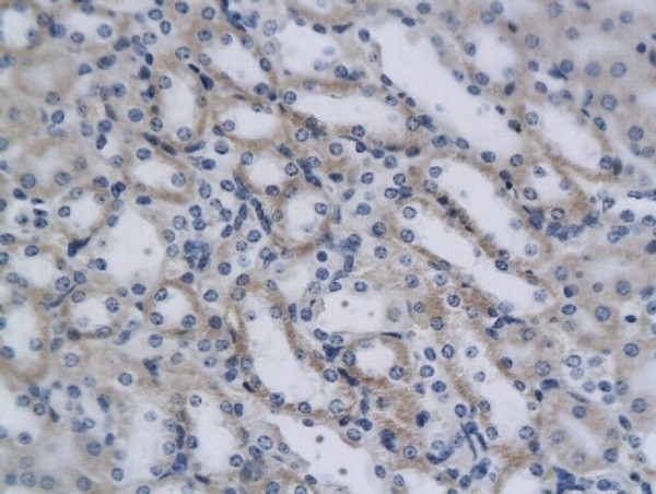 CD4 Antibody in Immunohistochemistry (Paraffin) (IHC (P))