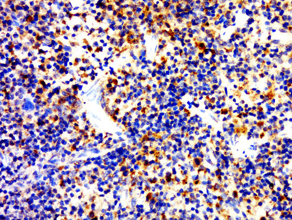 CD4 Antibody in Immunohistochemistry (Paraffin) (IHC (P))