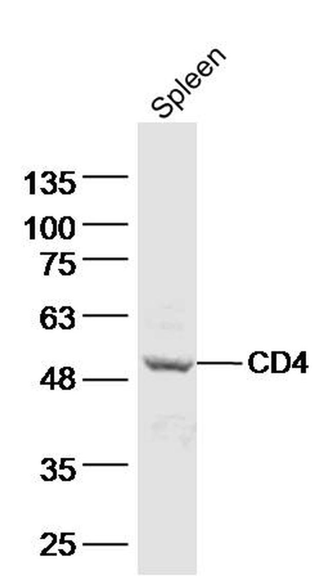 CD4 Antibody in Western Blot (WB)