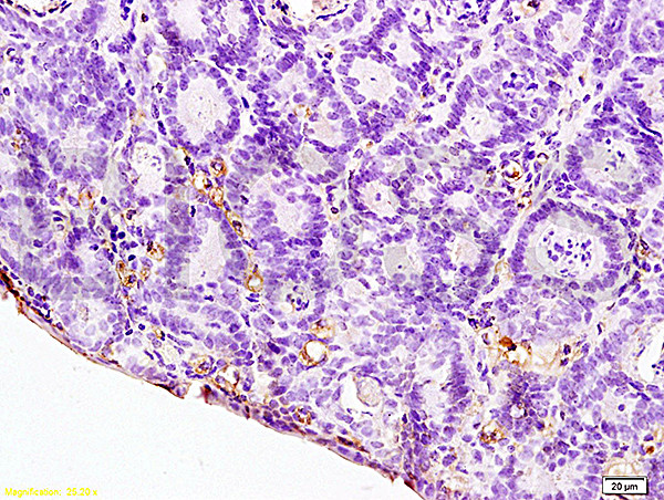 IL-12 alpha Antibody in Immunohistochemistry (Paraffin) (IHC (P))