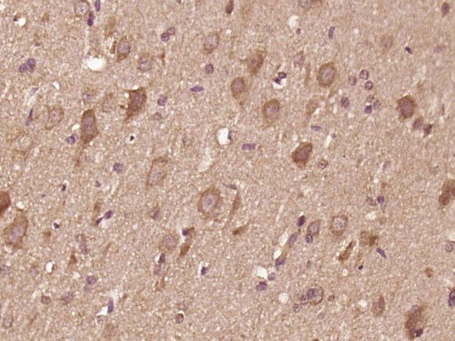 IL-12 alpha Antibody in Immunohistochemistry (Paraffin) (IHC (P))