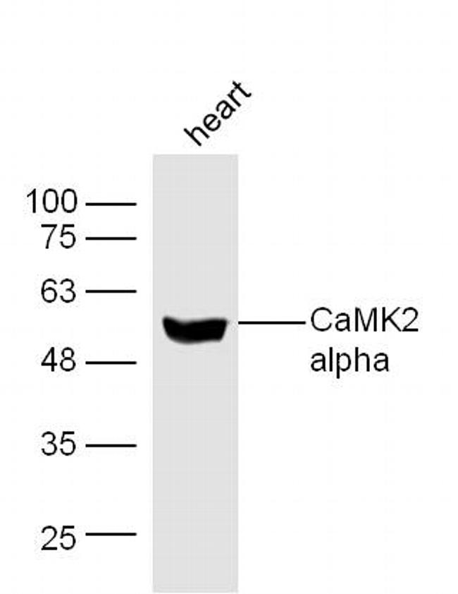 CaMK2 Antibody in Western Blot (WB)