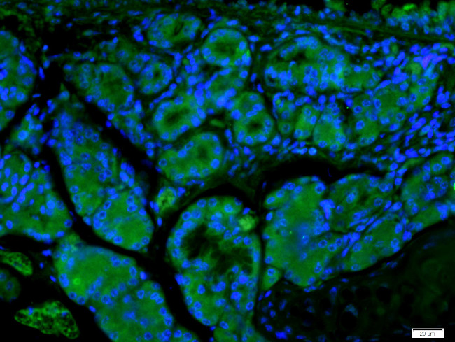 ECM1 Antibody in Immunohistochemistry (Paraffin) (IHC (P))