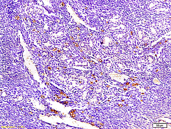 ECM1 Antibody in Immunohistochemistry (Paraffin) (IHC (P))