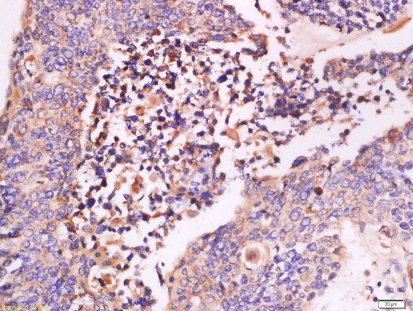 IFN-beta Antibody in Immunohistochemistry (Paraffin) (IHC (P))