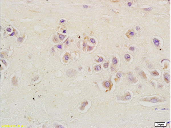 RSL1D1 Antibody in Immunohistochemistry (Paraffin) (IHC (P))