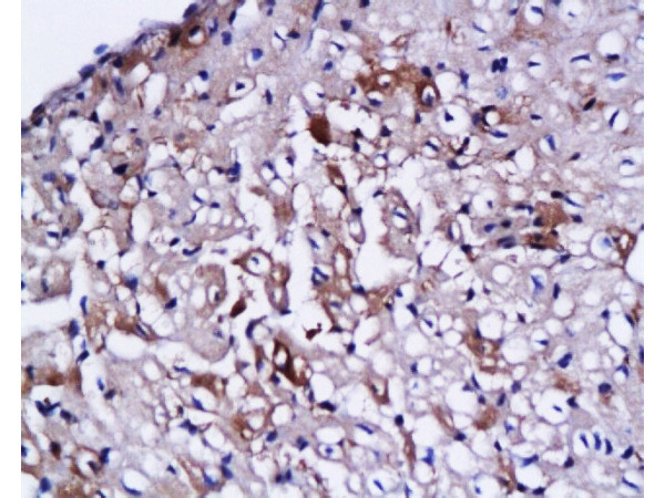 cardiac Troponin I Antibody in Immunohistochemistry (Paraffin) (IHC (P))