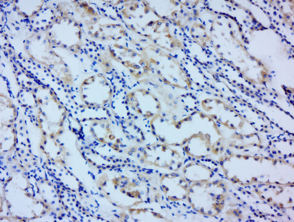 Angiopoietin 1 Antibody in Immunohistochemistry (Paraffin) (IHC (P))