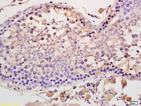 ACVR2A + ACVR2B Antibody in Immunohistochemistry (Paraffin) (IHC (P))