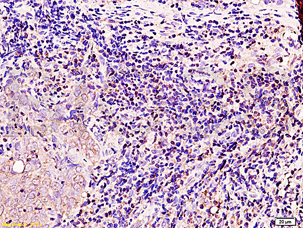 BRCA1 Antibody in Immunohistochemistry (Paraffin) (IHC (P))