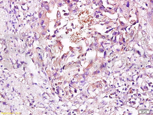 CD56 Antibody in Immunohistochemistry (Paraffin) (IHC (P))