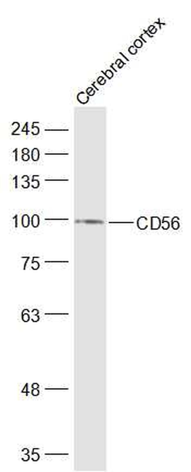 CD56 Antibody in Western Blot (WB)