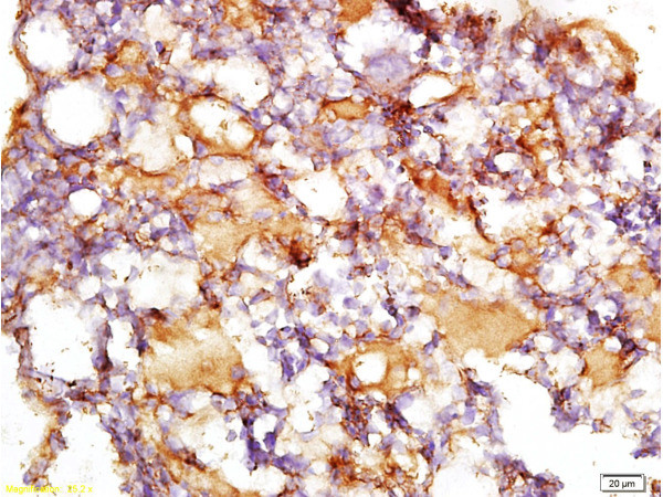 Collagen 4 Antibody in Immunohistochemistry (Paraffin) (IHC (P))