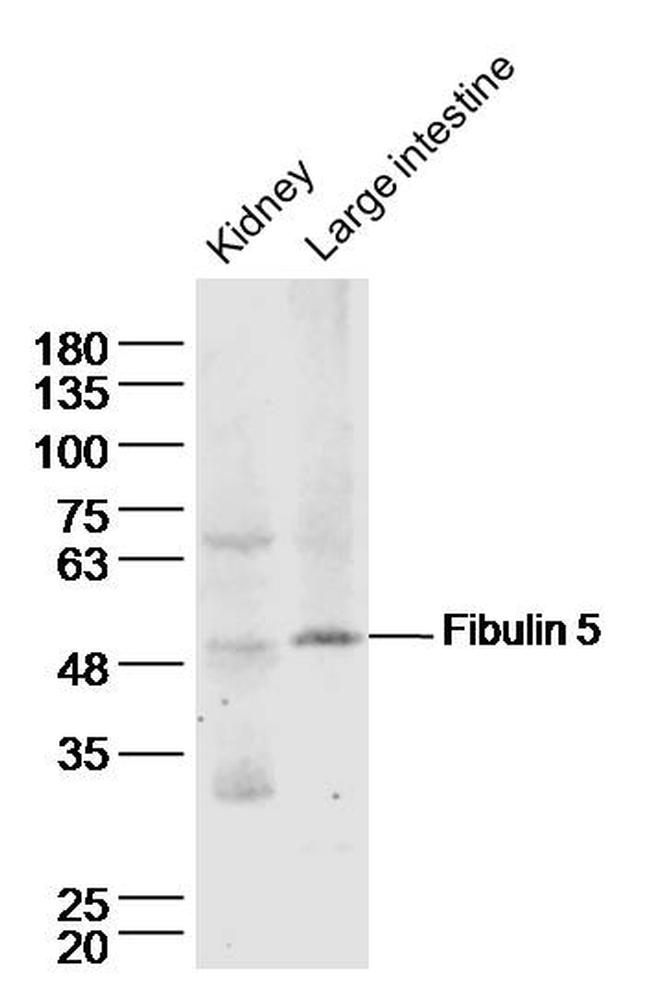 Fibulin 5 Antibody in Western Blot (WB)