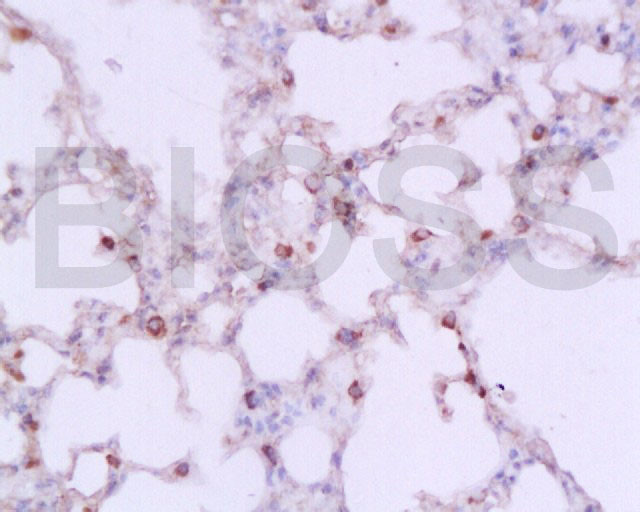 IL-1 Beta Antibody in Immunohistochemistry (Paraffin) (IHC (P))