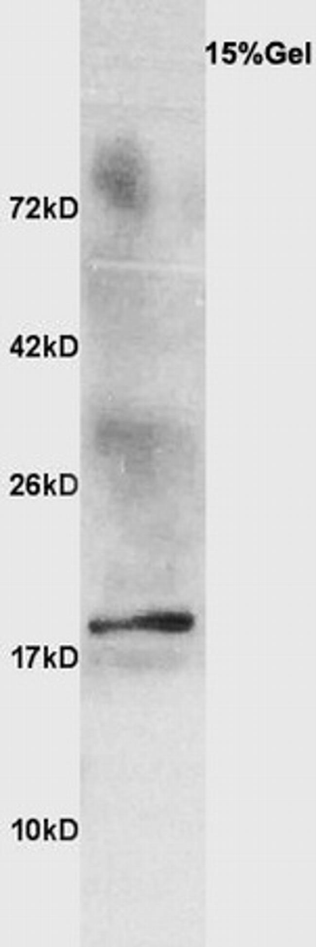 beta lactoglobulin Antibody in Western Blot (WB)