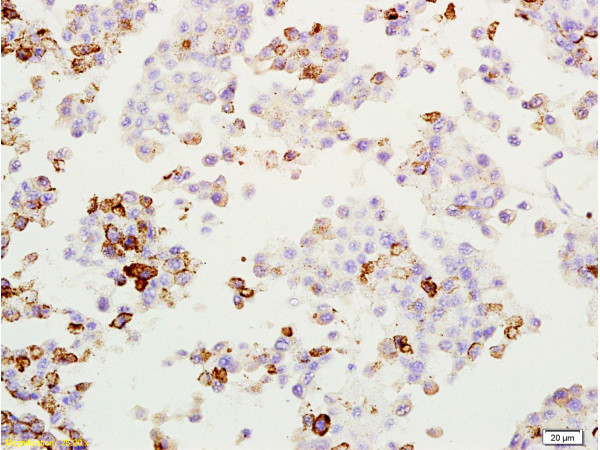 MAGE-1 Antibody in Immunohistochemistry (Paraffin) (IHC (P))