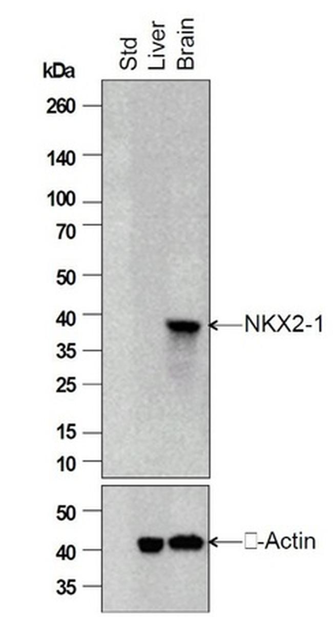 TTF-1 Antibody in Western Blot (WB)