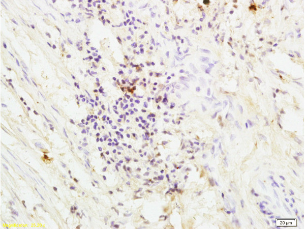 Thrombin receptor Antibody in Immunohistochemistry (Paraffin) (IHC (P))