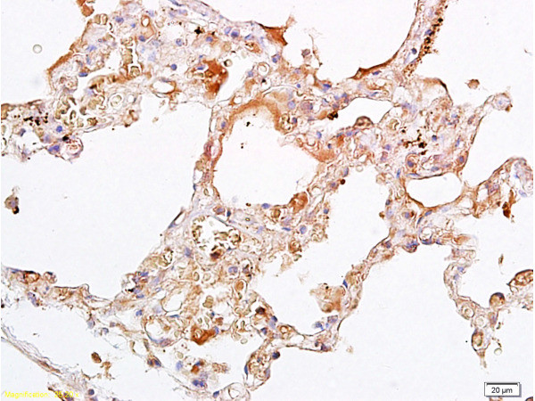 OCT4 Antibody in Immunohistochemistry (Paraffin) (IHC (P))