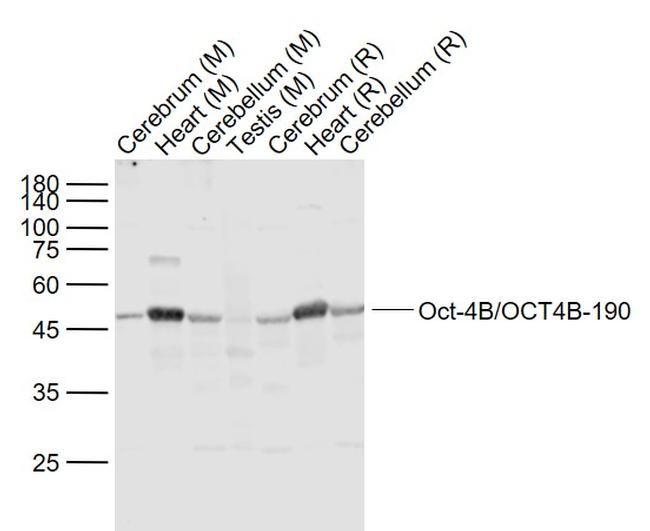 OCT4 Antibody in Western Blot (WB)