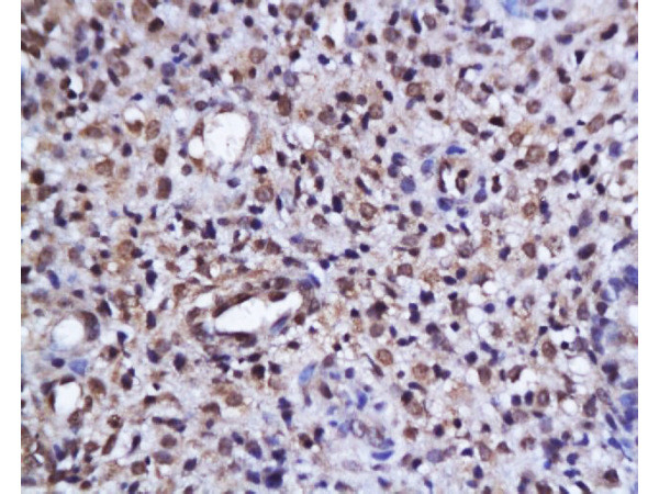 Phospho-AKT1/2/3 (Ser473) Antibody in Immunohistochemistry (Paraffin) (IHC (P))