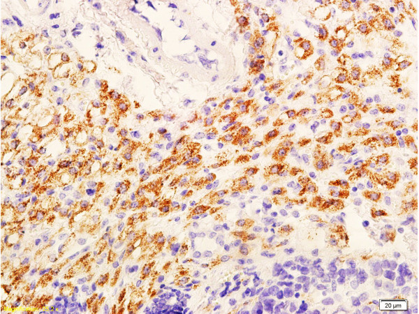 Phospho-AKT1/2/3 (Ser473) Antibody in Immunohistochemistry (Paraffin) (IHC (P))