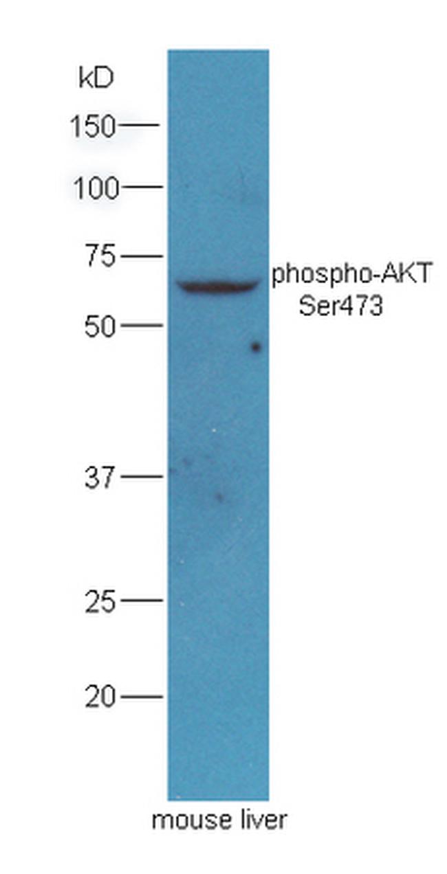 Phospho-AKT1/2/3 (Ser473) Antibody in Western Blot (WB)