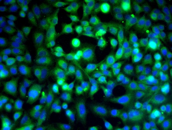 VE Cadherin Antibody in Immunocytochemistry (ICC/IF)