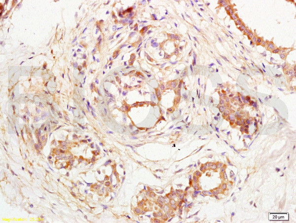 VE Cadherin Antibody in Immunohistochemistry (Paraffin) (IHC (P))