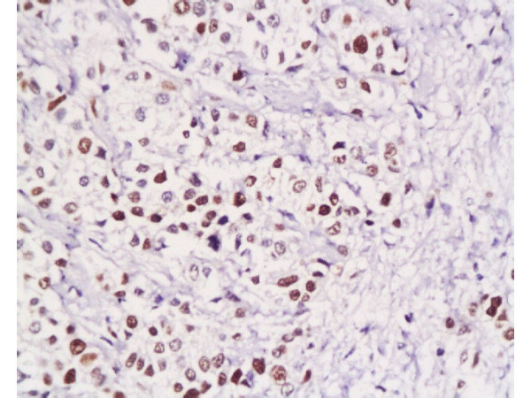 Pokemon Antibody in Immunohistochemistry (Paraffin) (IHC (P))