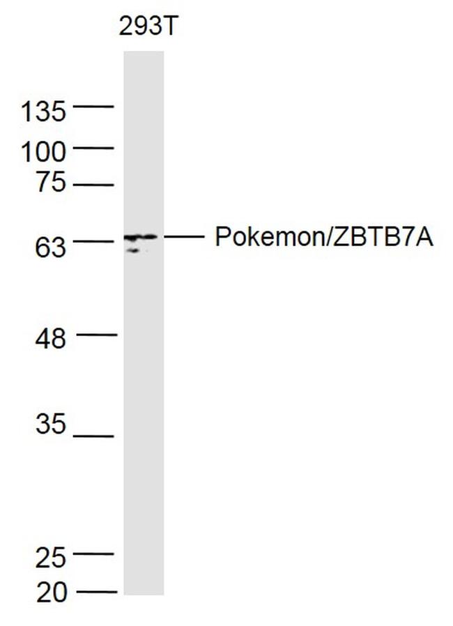 Pokemon Antibody in Western Blot (WB)